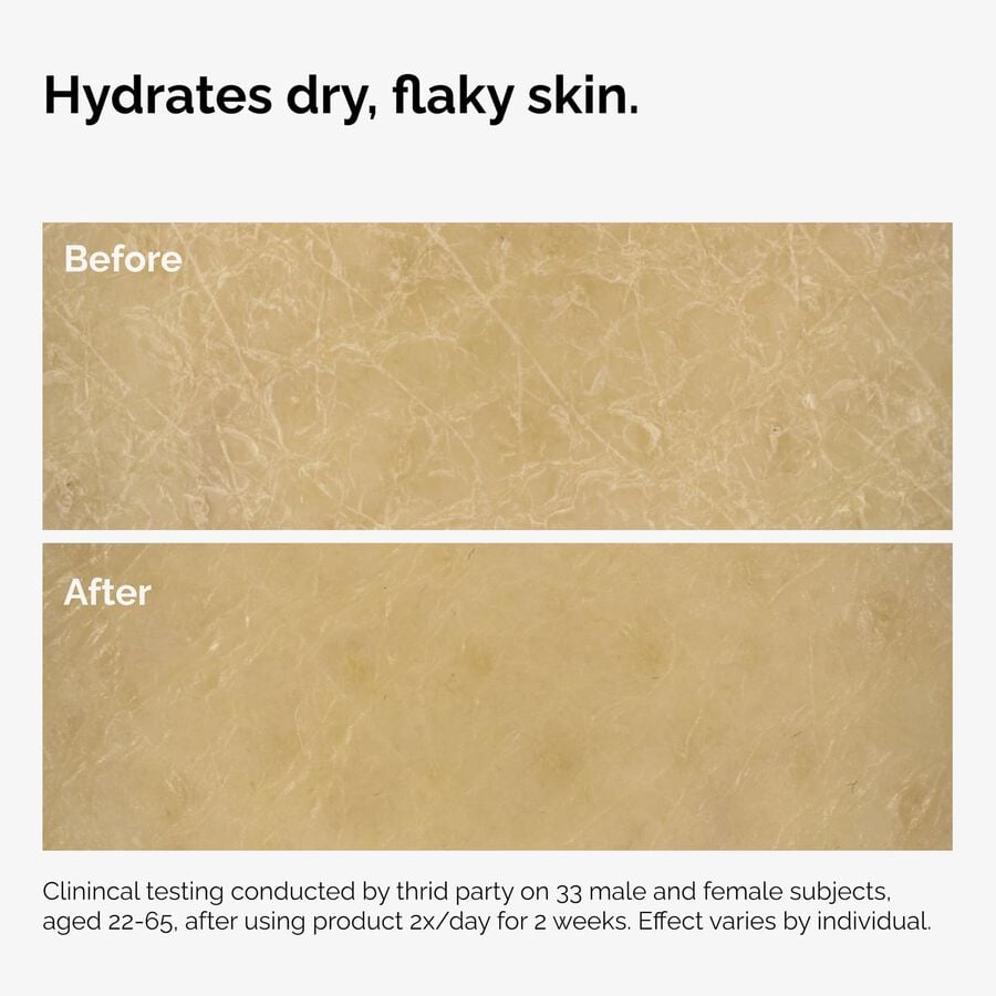 the-body-care-collection-o6 ord-natural-moisturizing-factors-inulin-body-before-after-graphic-02.jpg