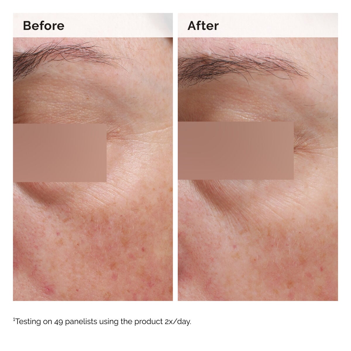niacinamide-5-face-and-body-emulsion-x9 2024-08-23-ORD-Nia-5pct-Face-Body-B-A-Elasticity-Global-02-1x1.jpg