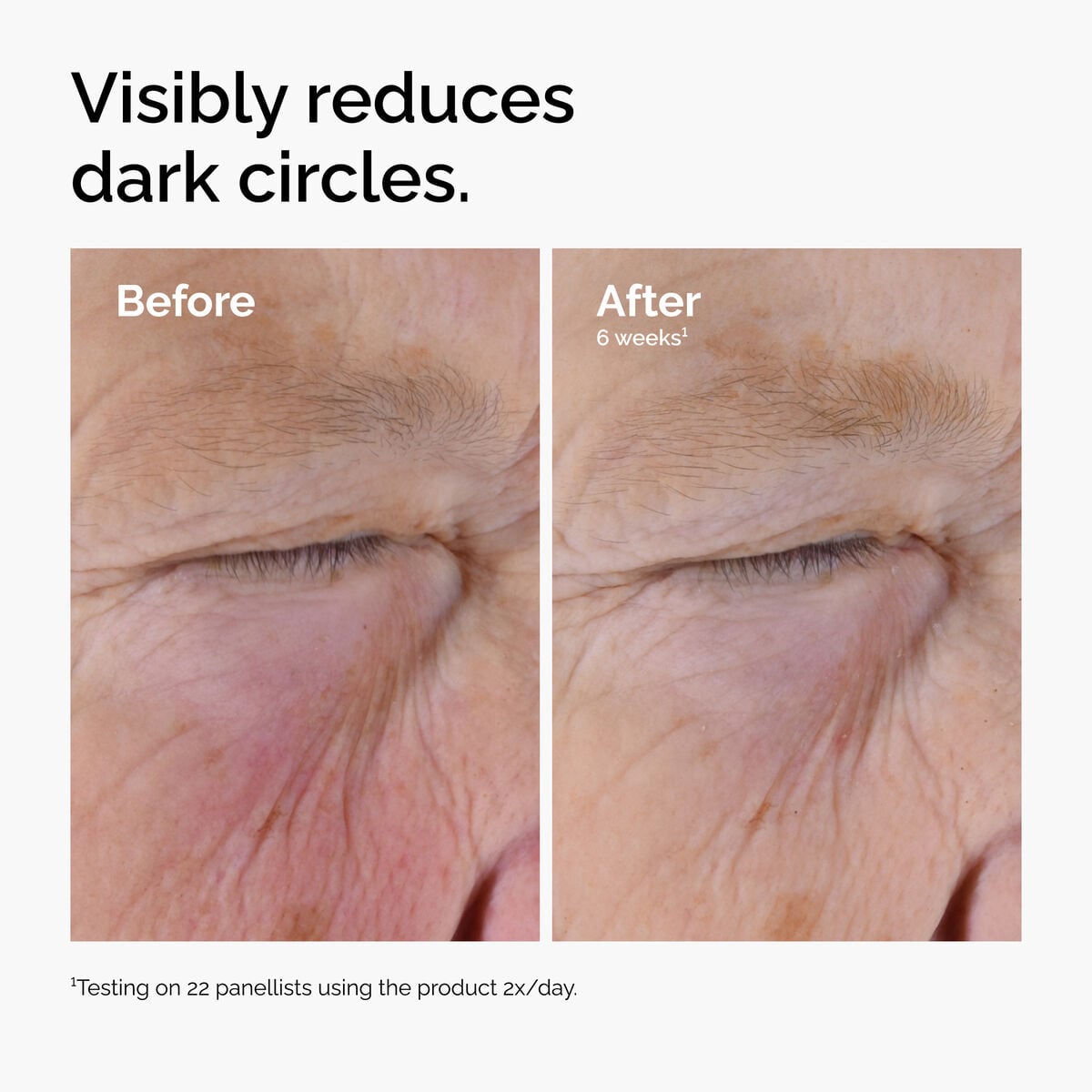 caffeine-solution-5-egcg-eye-serum-b1 ord-caffeine-solution-egcg-dark-circles-before-after.jpg