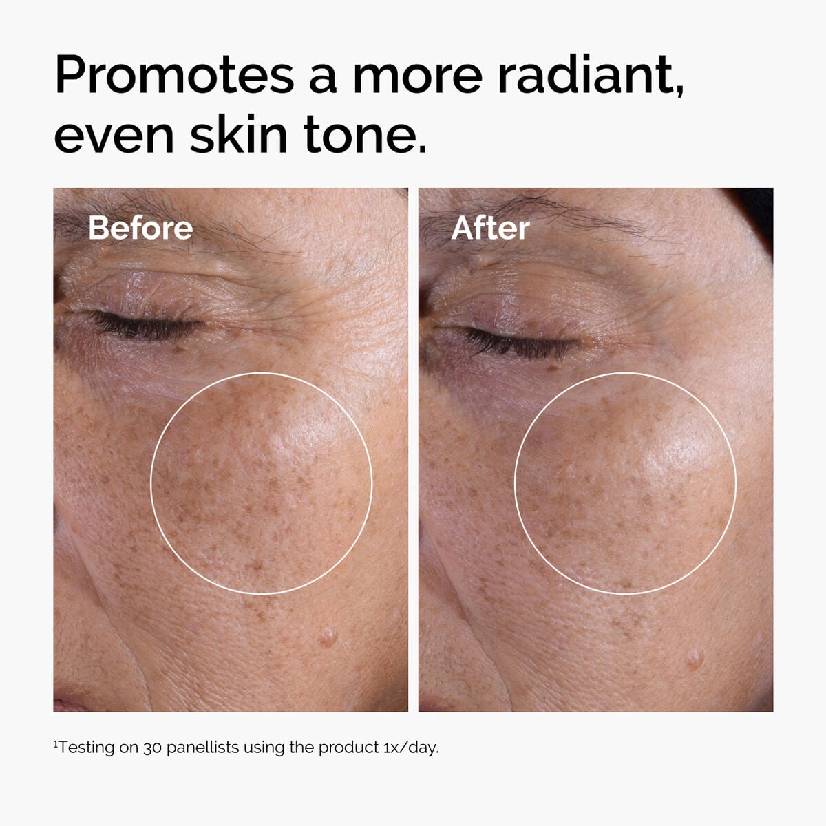 glycolic-acid-7-exfoliating-toner-r1 ord-glycolic-before-after-radiance.jpg