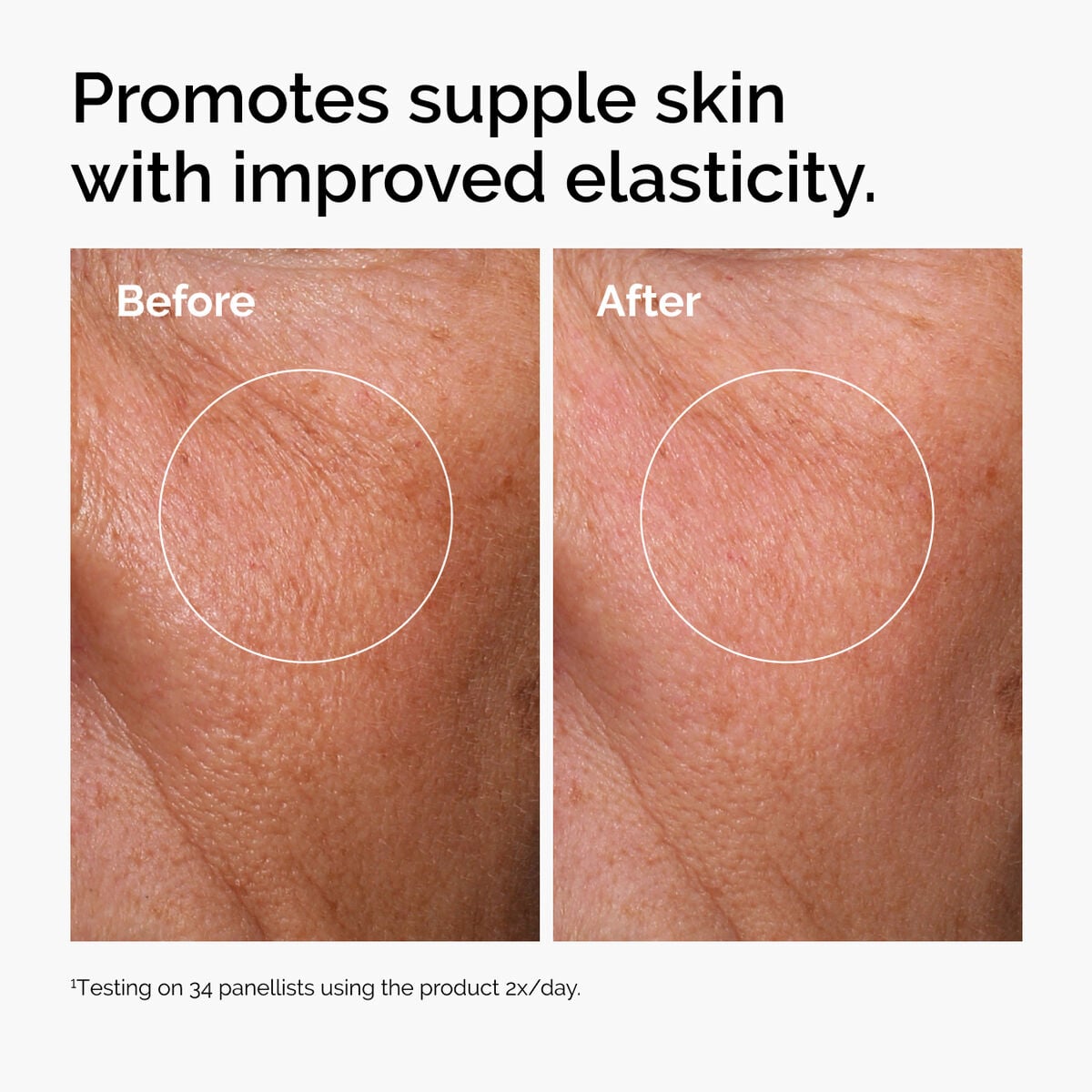 hyaluronic-acid-2-b5-with-ceramides-z3 ord-hyaluronic-acid-2pct-b5-hydrating-serum-before-after-elasticity.jpg
