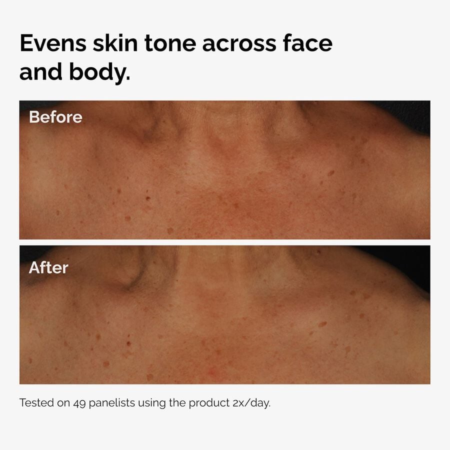 the-body-care-collection-o6 ord-niacinamide-face-body-serum-before-after-even-tone-graphic.jpg